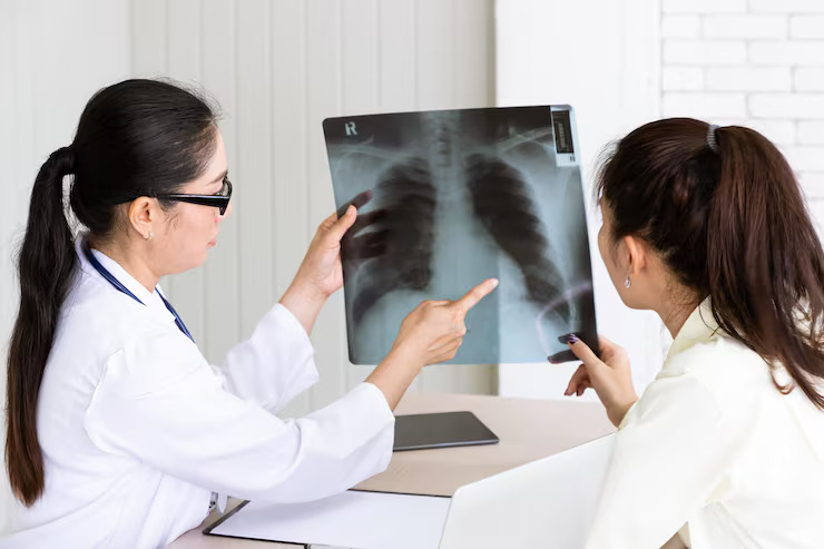 Breast Cancer Surgery